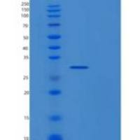 人蛋白酶体装配伴侣蛋白2(PSMG2)重组蛋白