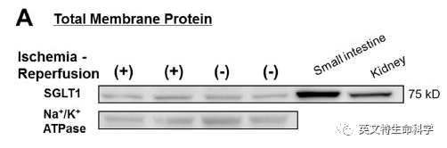 膜蛋白研究“宝藏级”分离工具应用全方案