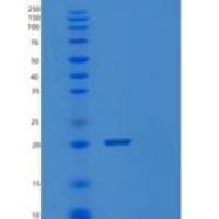 大肠杆菌ppa重组蛋白
