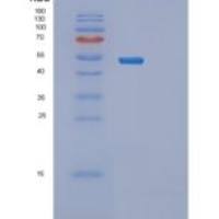 人PRKAR2A重组蛋白
