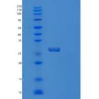 小鼠丝氨酸蛋白酶28(PRSS28)重组蛋白