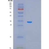 人AMP激活蛋白激酶β1(PRKAb1)重组蛋白