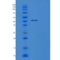 人PPME1重组蛋白