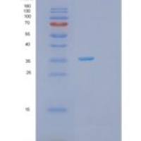 人PRPS1重组蛋白