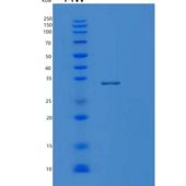 人Mg2+/Mn2+依赖性蛋白磷酸酶1D(PPM1D)重组蛋白