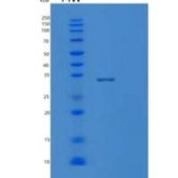 人Mg2+/Mn2+依赖性蛋白磷酸酶1D(PPM1D)重组蛋白