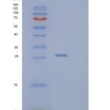 人PSMB10重组蛋白
