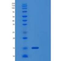 人蛋白酶体装配伴侣蛋白4(PSMG4)重组蛋白