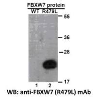 FBXW7 (R479L)