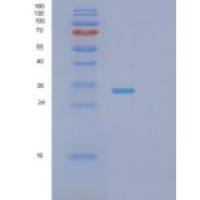 人蛋白酶体亚基α1(PSMa1)重组蛋白