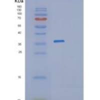 人干扰素诱导双链RNA依赖蛋白激酶激活因子A(pr kra)重组蛋白