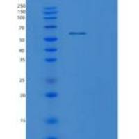 人蛋白磷酸酶1G(PPM1G)重组蛋白
