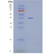 人AMP激活蛋白激酶γ1(PRKAg1)重组蛋白