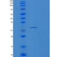 人蛋白酶体亚基α8(PSMa8)重组蛋白