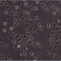 【STR鉴定】5637、5637细胞、5637膀胱癌细胞