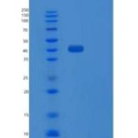 人非受体型蛋白酪氨酸磷酸酶7(PTPN7)重组蛋白