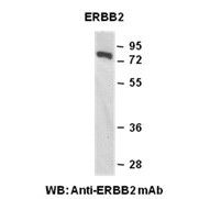 ERBB2 Monoclonal Antibody