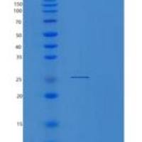 人蛋白酶体亚基β3(PSMb3)重组蛋白