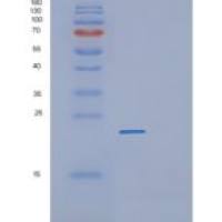 人蛋白酪氨酸磷酸酶型IVA 3（pr L3）重组蛋白