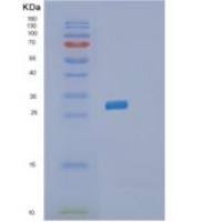 人醌型二氢蝶啶还原酶(QDPR)重组蛋白
