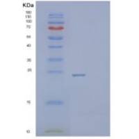 人PSMB2重组蛋白