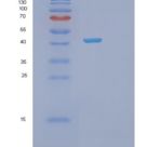 人磷酸丝氨酸转氨酶1(PSAT1)重组蛋白