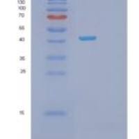 人磷酸丝氨酸转氨酶1(PSAT1)重组蛋白