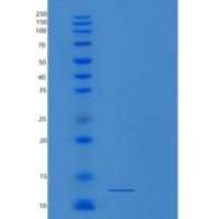 小鼠S100钙结合蛋白A10(S100A10)重组蛋白