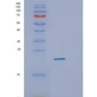 人蛋白磷酸酶1调节因子亚基2(PPP1R2)重组蛋白