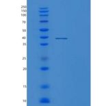 人蛋白磷酸酶1催化亚基α亚型(PPP1Ca)重组蛋白