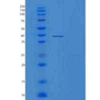 人蛋白磷酸酶1催化亚基α亚型(PPP1Ca)重组蛋白