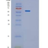 人PPP3CA重组蛋白