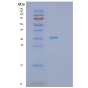 人PRPS2重组蛋白