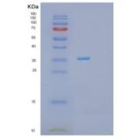 人PRPS2重组蛋白