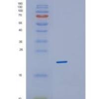 人蛋白磷酸酶3调节因子亚基1(PPP3R1)重组蛋白