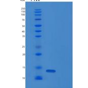 人胸腺旁腺素(PTMS)重组蛋白