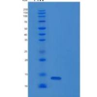 人胸腺旁腺素(PTMS)重组蛋白