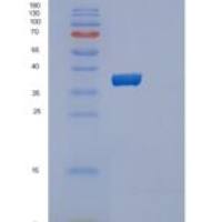 人肽基脯氨酰异构酶E(PPIE)重组蛋白