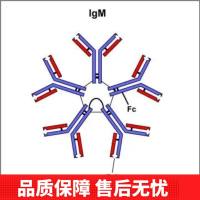 Anti-Beta Adducin/ADD2 Antibody