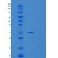 人蛋白酶体亚基β8(PSMb8)重组蛋白