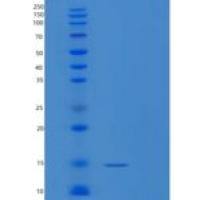 人PTRH2重组蛋白