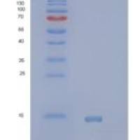 人小白蛋白(PVALB)重组蛋白