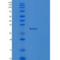 人PRRT2重组蛋白