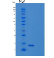 人胸腺旁腺素(PTMS)重组蛋白