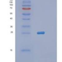 人朊病毒蛋白(PRNP)重组蛋白