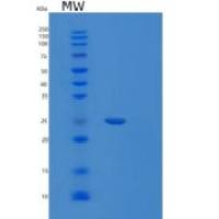 人蛋白酶体亚基β4(PSMb4)重组蛋白