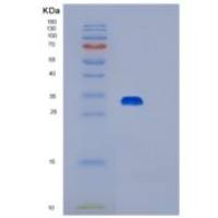 人AMP激活蛋白激酶β2(PRKAb2)重组蛋白