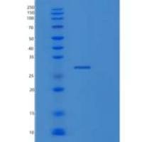 人RAB11A重组蛋白