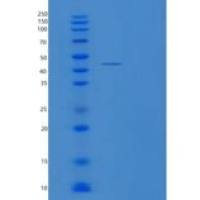 人QTRT1重组蛋白