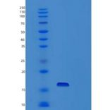 人抑丝蛋白4(PFN4)重组蛋白